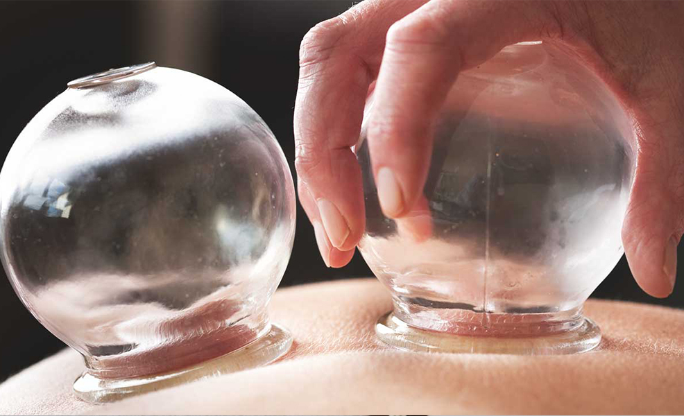 Cupping